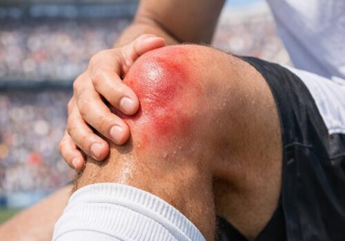 Wenn der Körper Alarm schlägt: So erkennen Sie erste Anzeichen von Sportverletzungen und handeln richtig